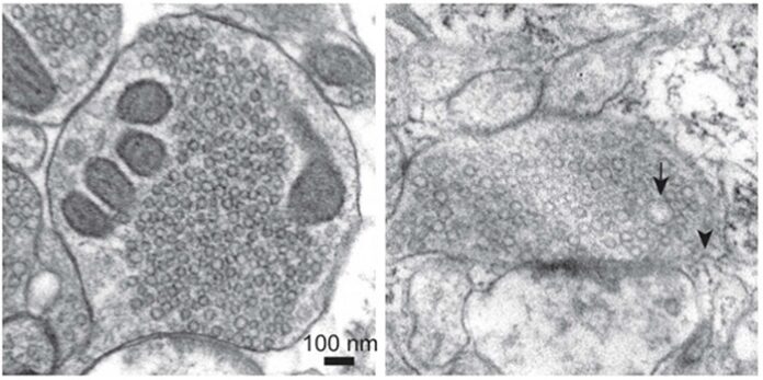 scientists-capture-learning-in-action-with-zap-and-freeze-brain-imaging