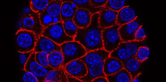 scientists-decode-pancreatic-cancer-develops-drug-resistance