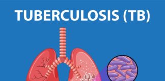 why-tb-persists-as-scientists-identify-secret-shield