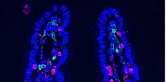 chemotherapy-reshapes-gut-microbiota-to-strengthen-anti-metastatic-immunity
