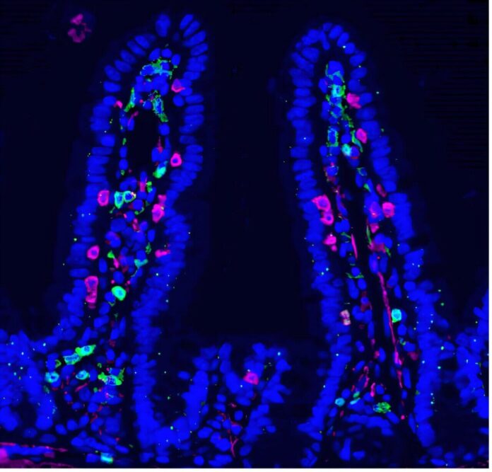 Chemotherapy Reshapes Gut Microbiota to Strengthen Anti-Metastatic Immunity chemotherapy-reshapes-gut-microbiota-to-strengthen-anti-metastatic-immunity