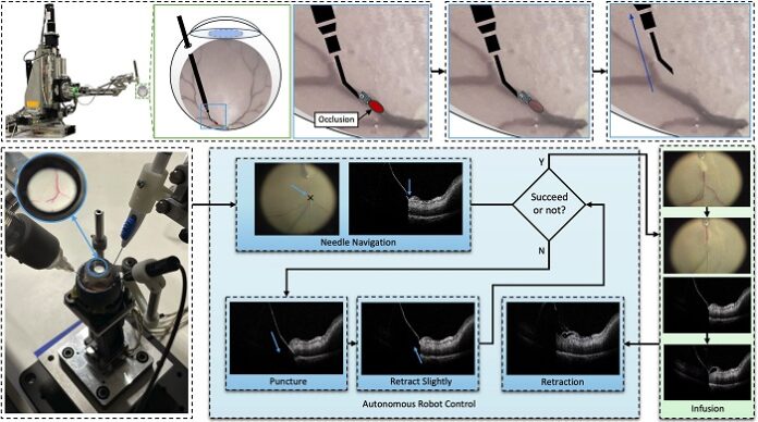 Deep Learning–Guided Robotics Advance Retinal Microsurgery deep-learning-guided-robotics-advance-retinal-microsurgery