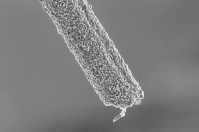 Diamond-Coated Neural Electrodes Offer New Hope for Spinal Injury Recovery diamond-coated-neural-electrodes-offer-new-hope-for-spinal-injury-recovery