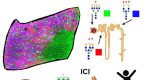 looking-beyond-genes-sugars-reveal-who-benefits-from-immunotherapy