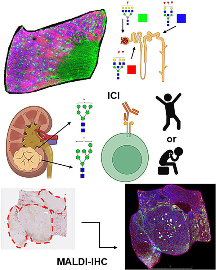 looking-beyond-genes-sugars-reveal-who-benefits-from-immunotherapy