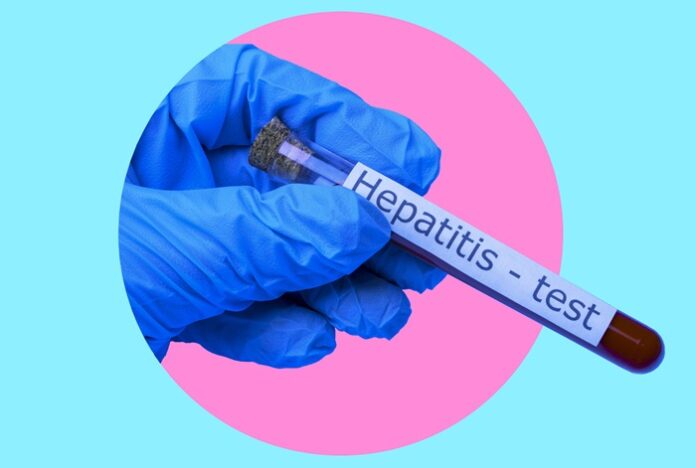 Art collage, a hand in a medical glove holding a blood test tube for hepatitis.