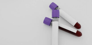 hba1c-test-may-misrepresent-blood-sugar-levels-in-indians-lancet-review