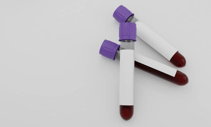 hba1c-test-may-misrepresent-blood-sugar-levels-in-indians-lancet-review