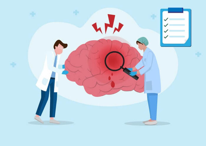 One in Seven Stroke Patients in India Is Under 45: National Registry Findings