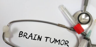 resveratrol-copper-combo-shows-promise-against-aggressive-brain-tumors