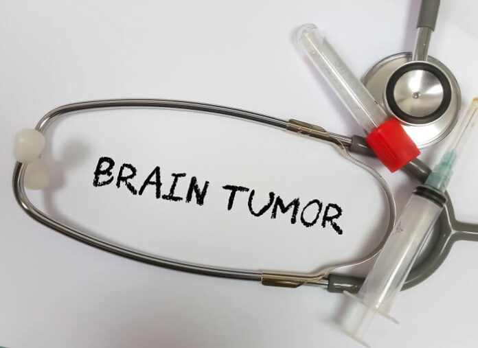 Resveratrol–Copper Combo Shows Promise Against Aggressive Brain Tumors resveratrol-copper-combo-shows-promise-against-aggressive-brain-tumors