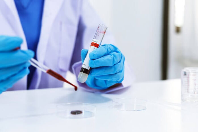 Choosing the Right Medical Laboratory A Key Step Toward Better Healthcare