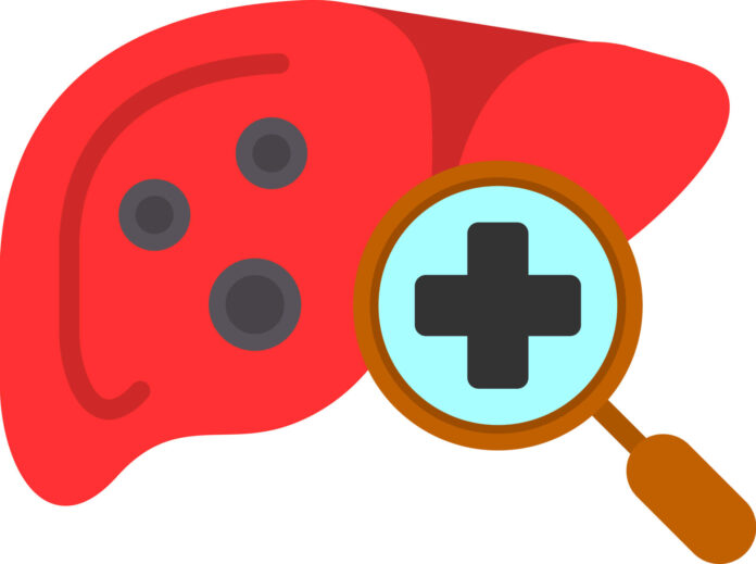 One in Four Diabetes Patients in India Has Hidden Liver Fibrosis Study