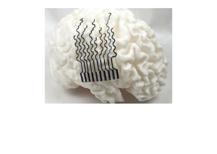 Researchers Develop 3D-Printed Hydrogel Brain Electrodes for Better Monitoring