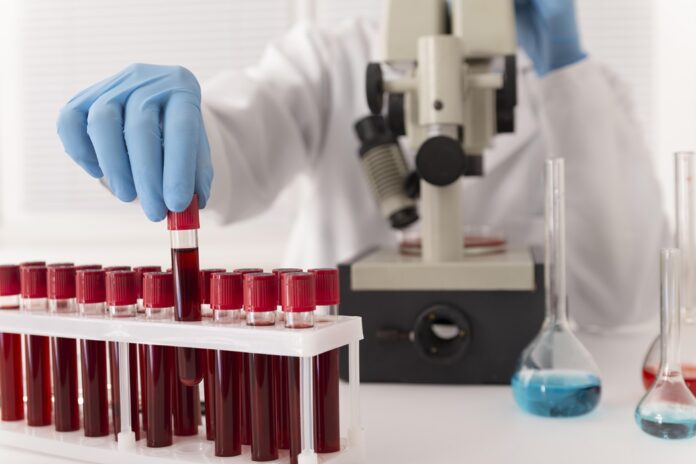 Blood Test May Predict Lung Cancer More Than Five Years Before Diagnosis