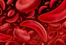 India Aims to Eliminate Sickle Cell Anaemia Before 2047, Says President Murmu