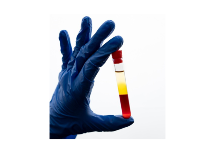 Odisha: MKCG MCH Begins Advanced Plasma and Red Cell Exchange Therapies