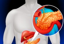 Fatty Pancreas Recognised as a Disease, Linked to Diabetes and Cancer