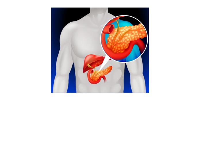 Fatty Pancreas Recognised as a Disease, Linked to Diabetes and Cancer