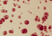 Nine in 10 Indian Adults Have Abnormal Blood Lipids, Study Warns