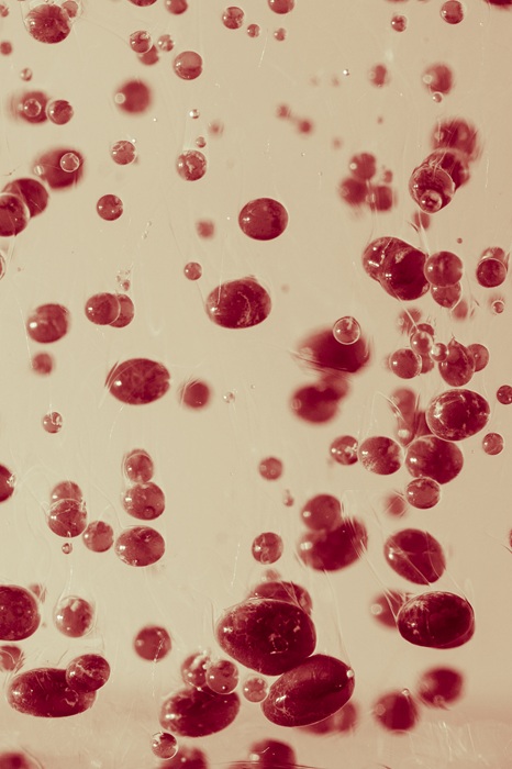 Nine in 10 Indian Adults Have Abnormal Blood Lipids, Study Warns