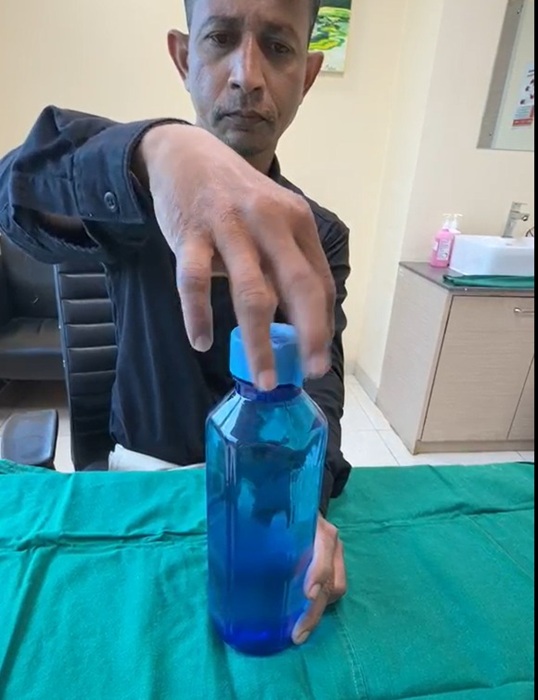 From a Crushed Finger to a Working Hand Engineer Regains Hand Function After PIP Joint Replacement