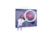 Study Identifies Genetic Risk Factor for Lung Cancer in Never-Smokers