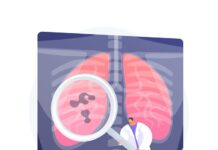 India Can Draw Lessons From Global Lung Cancer Screening Practices: AIIMS Expert