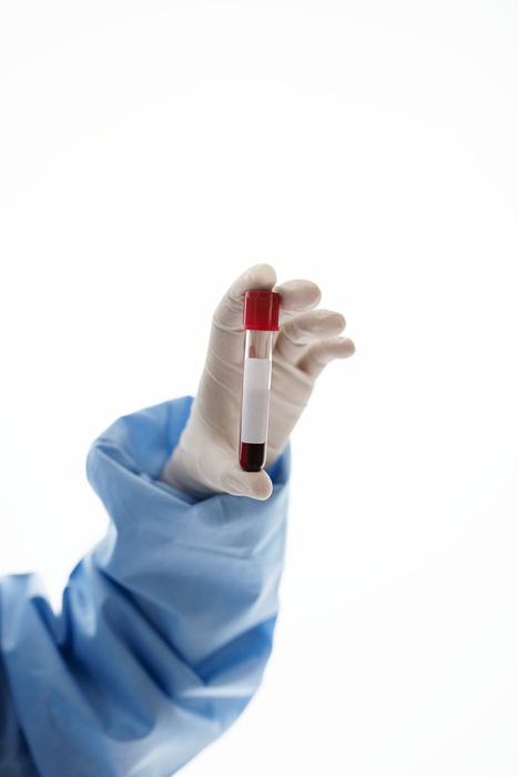 Doctor holding a blood test tube