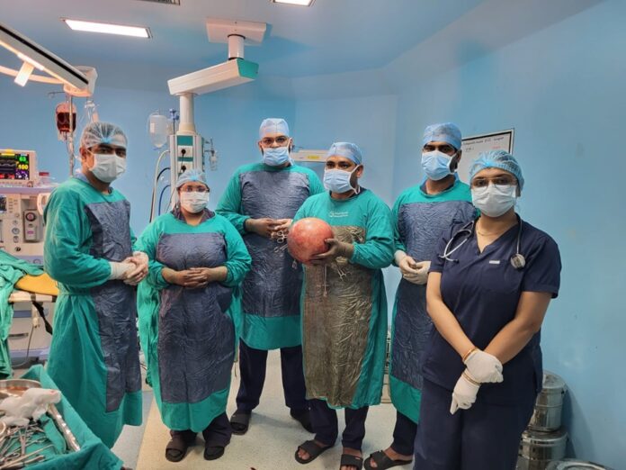 SilverStreak Hospital Successfully Removes 7.06 Kg Abdominal Tumour