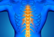 Thoracic Spinal Anaesthesia Shows 97% Success in Laparoscopic Hysterectomy