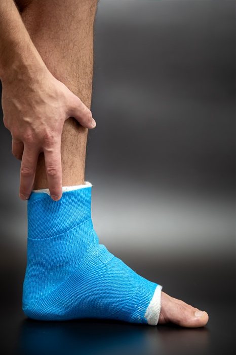 Close up photos of foot blue splint for treatment of injuries from ankle sprain.